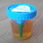 Oorzaak en symptomen van troebele urine met vlokken