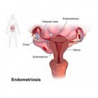 Vulva (schaamlippen/clitoris/urinebuis), vagina, baarmoeder